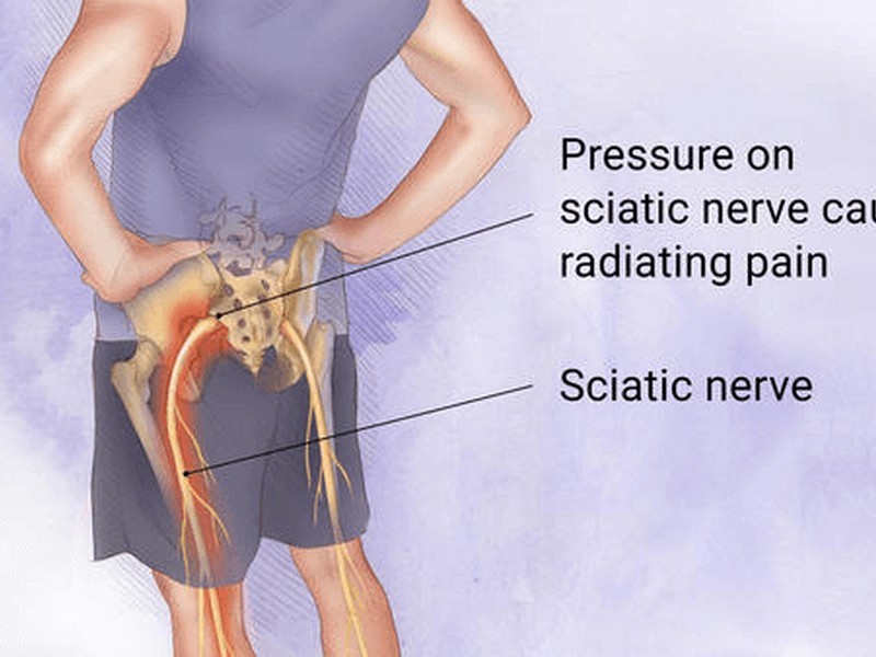 Bulging Disk Pain Chiropractor Bundall Near Me